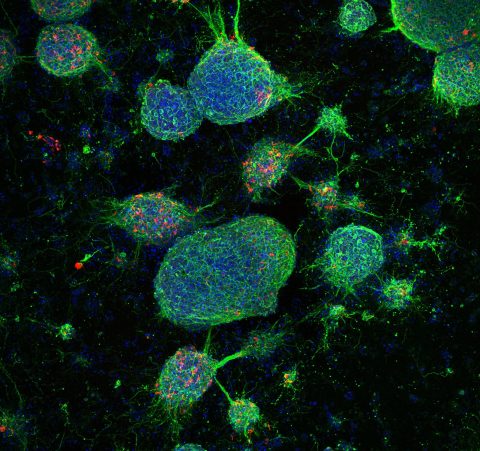Realizamos con éxito un estudio científico para el tratamiento de lesiones medulares